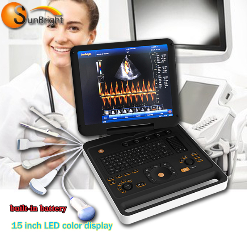 Factory price sonoscape s8 portable ultrasound color Doppler cost efficient model