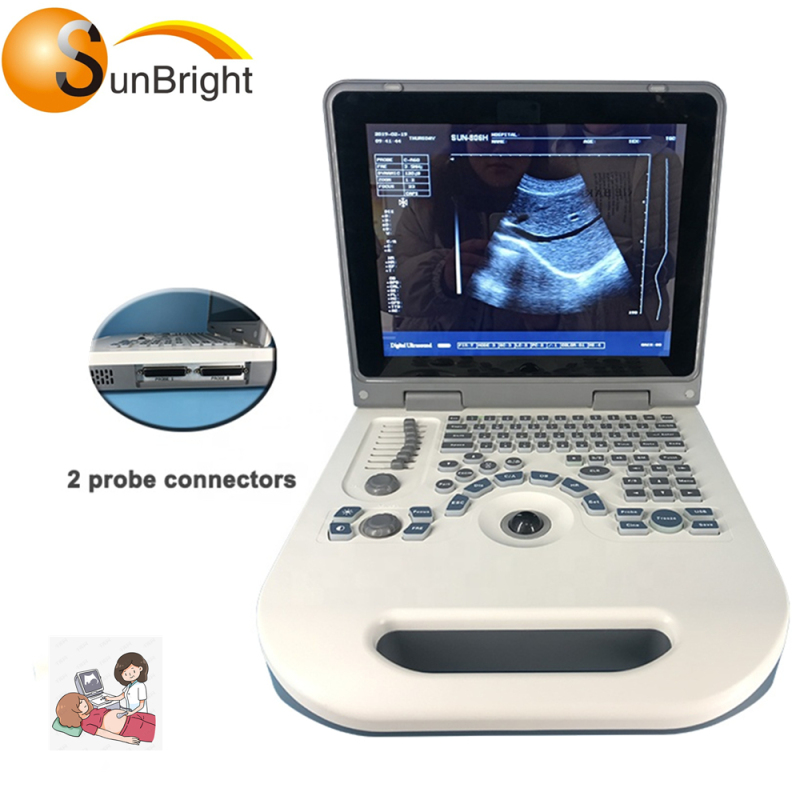 same quality with mindray equipos de ultrasonido portatiles portable echo ultrasound equipment