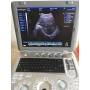 Win7 platform cheap price best quality therapeutic ultrasound unit
