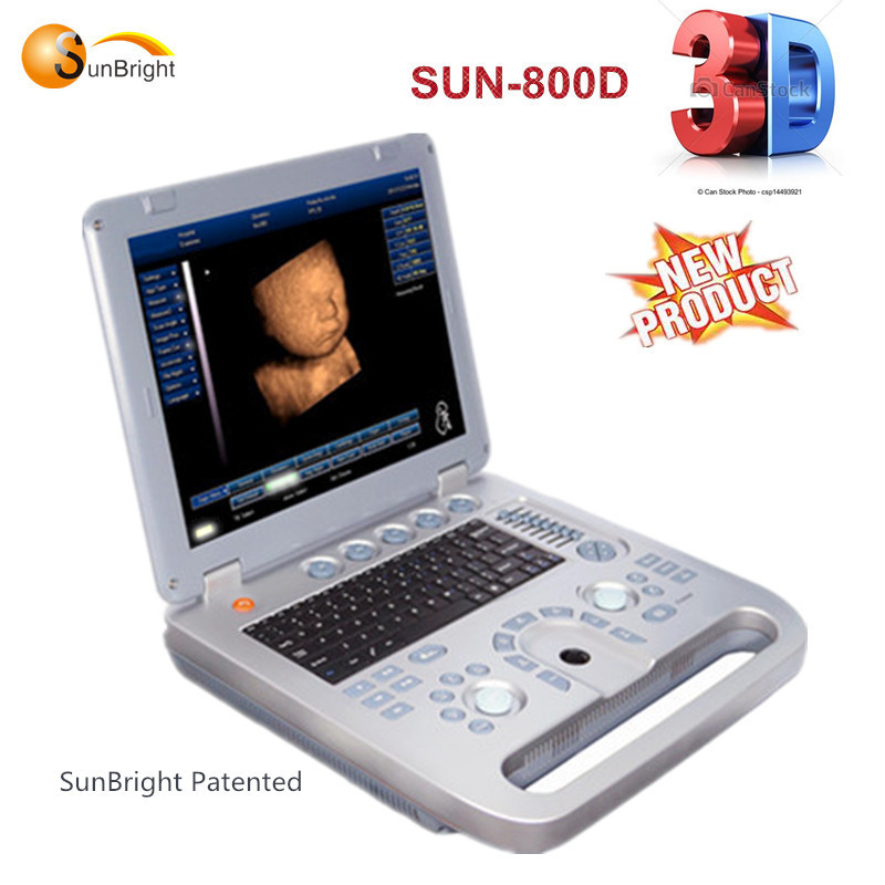 equipo de ginecología digital completo máquina de ultrasonido portátil 3D 4D