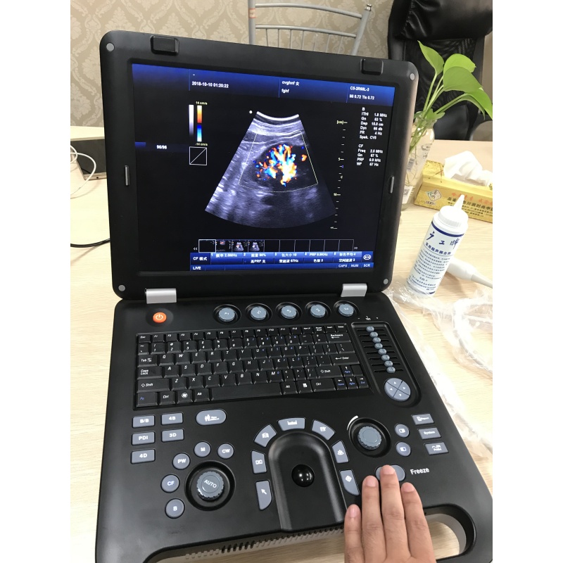 Portable laptop style ecografo portatil color doppler ultrasound scanning medical equipment