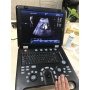 Portable laptop style ecografo portatil color doppler ultrasound scanning medical equipment