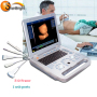 portable cheapest multi-function  laptop ultrasound machine for sale