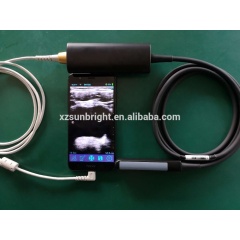 Smartphone tablet computer laptop support portable ultrasound rectal probe