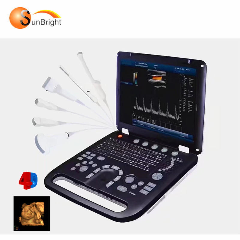 15인치 LED 휴대용 그레이트 이미지 4D 베이비 스캐닝 초음파 컬러 도플러 가격