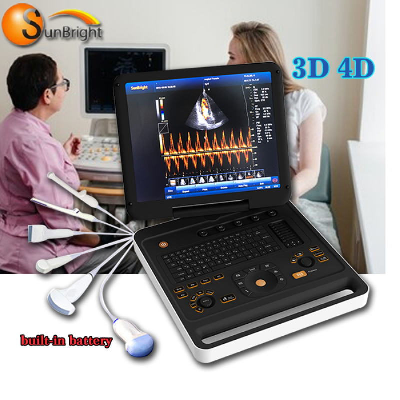 Portable Laptop Color Doppler Pregnancy Ultrasound Scanner Machine with digital ultrasonic diagnostic imaging system
