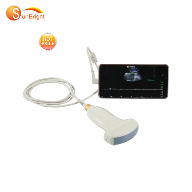 high performance full digital android wireless ultrasonic transducer handheld ultrasound probe