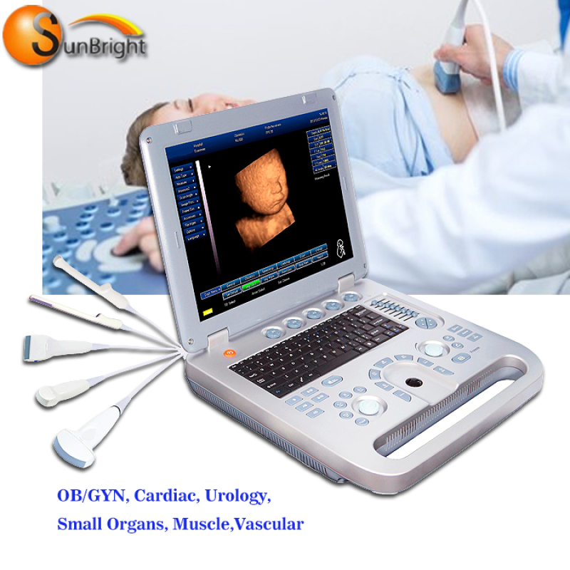 Popular promotional 3d 4d laptop ultrasonic flow meter china ultrasound