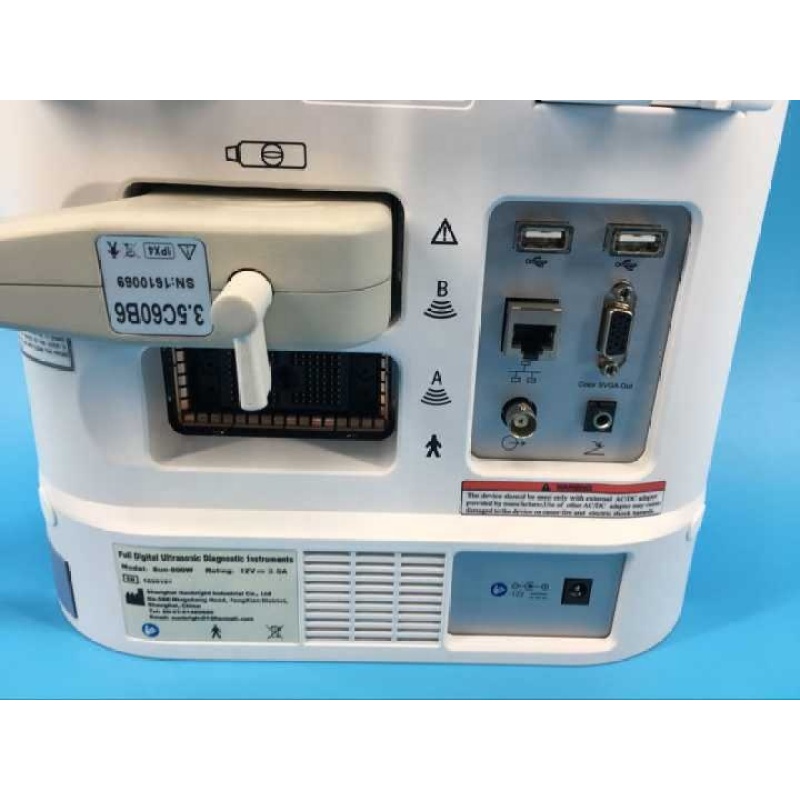 병원용 휴대용 디지털 초음파 스캐너 Sun-800W