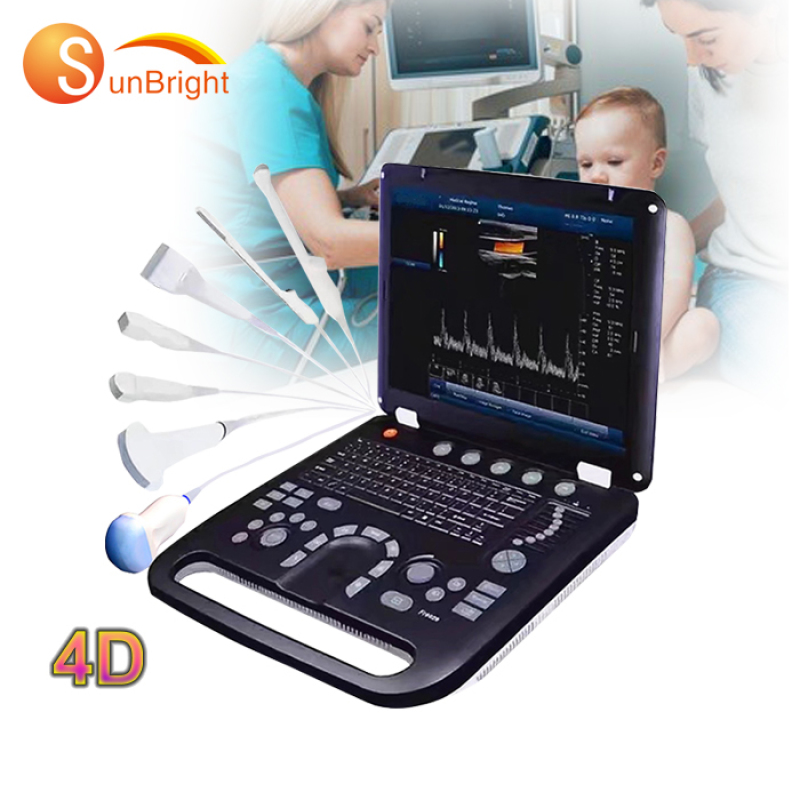 famous high quality 4D laptop color Doppler similar sonoscape portable Portable ultrasound vascular system