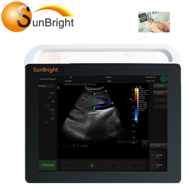 산부인과 휴대용 초음파 장비 가격을 위한 최고의 초음파 기계