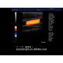 SUN-906W Ecocardiografia color doppler 2D al miglior prezzo