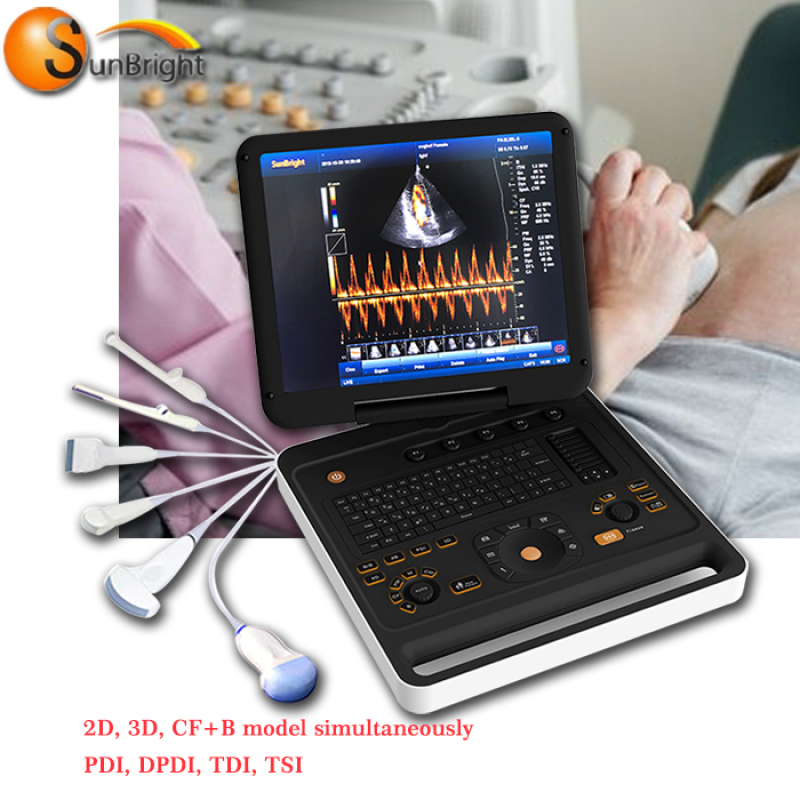 도플러 프로브 3D 휴대용 초음파 컬러 도플러 에코 기계 가격 임신 바디 모니터