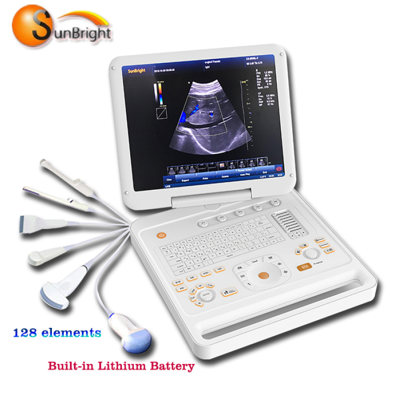 high quality portable laptop medical cardiac ecografo 4d color doppler ultrasound machine