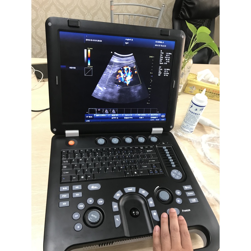 Portable 15 inch 3d 4d doppler ultrasound OB GYN color doppler imaging system