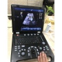 Portable 15 inch 3d 4d doppler ultrasound OB GYN color doppler imaging system