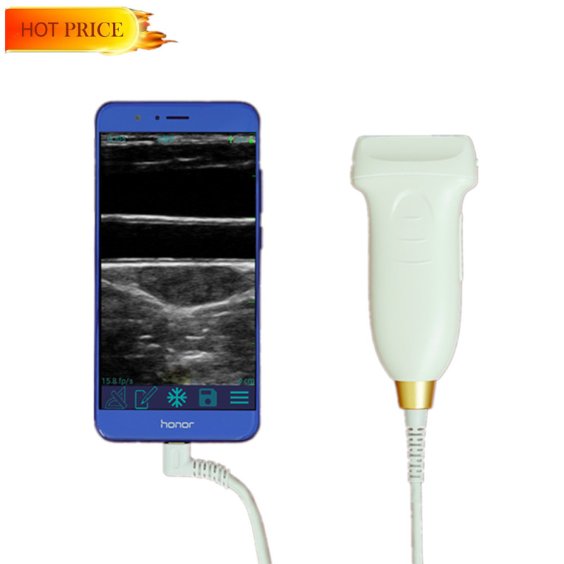 복부 부인과 산부인과 비뇨기과 용 포켓 usb 프로브 초음파
