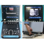 Portable 3D Color doppler ultrasound machine cardiac probe color Doppler cheap medical ultrasound instruments