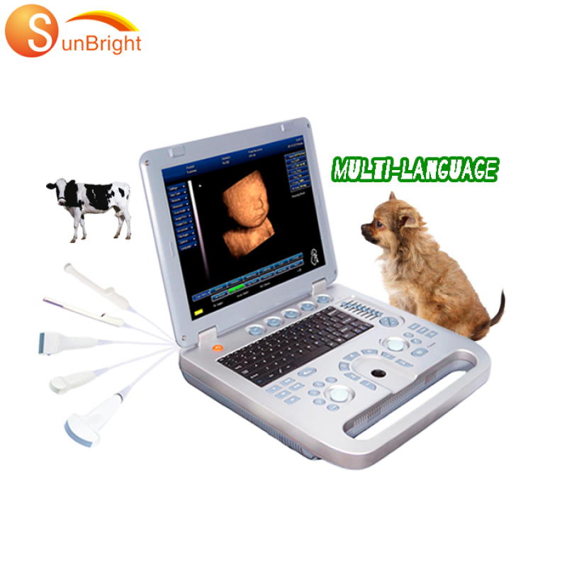 Повністю цифровий ультразвуковий діагностичний ультразвуковий сканер для ноутбуків 15 дюймів для ноутбуків