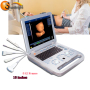Human Use Medical Portable Ultrasound OB GYN Diagnostic Ultrasound Machine