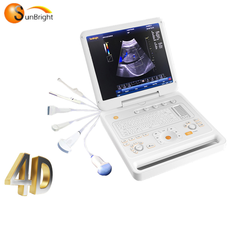 Pantalla de 15 pulgadas, batería incorporada, rendimiento de alto costo, ultrasonido doppler en color, precio más barato