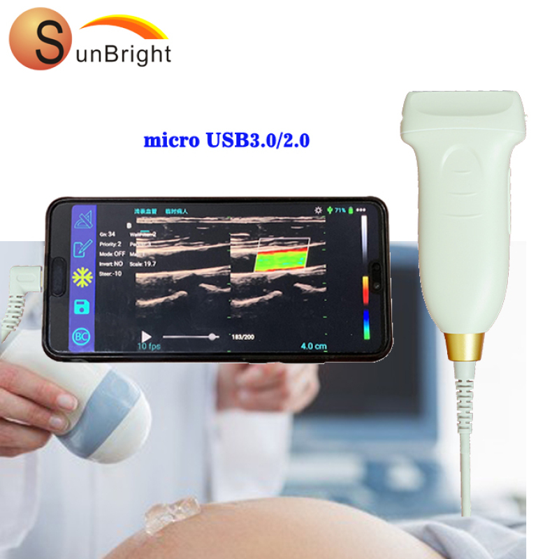 high sensitive linear ultrasound 14mhz probe from manufacturer for laptop with high resolution