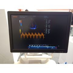 Stationary color Doppler 3d 4d full digital trolley doppler ultrasound