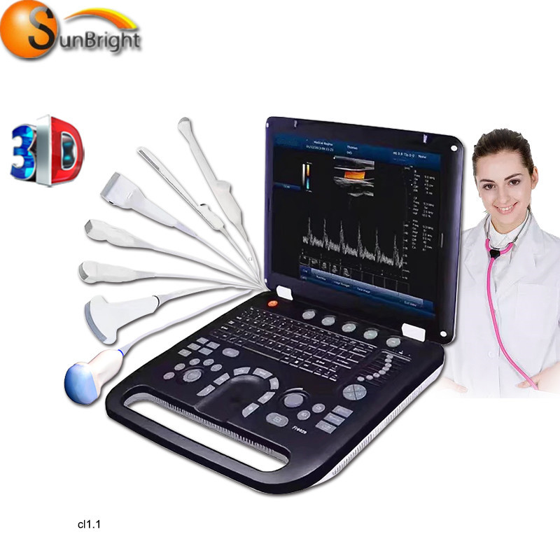 Portable 3d Color Doppler ultrasound machine printer phased array probe Doppler
