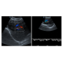 wireless usg ultrasound double head color Doppler probe