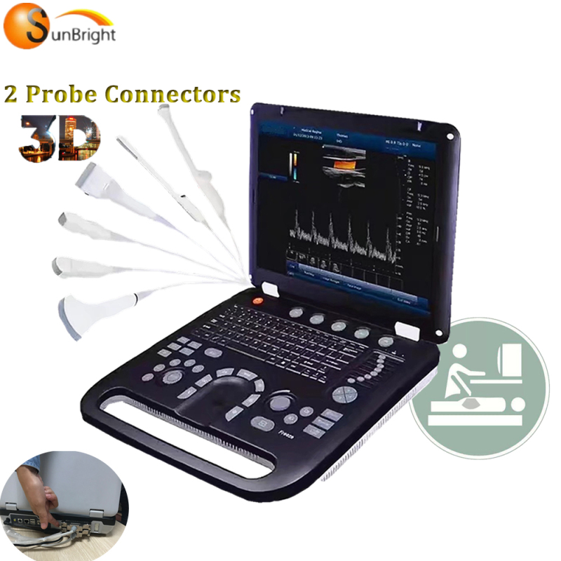 Portable CE laptop for baby pregnant lower price ultrasound machine linear probe type color doppler