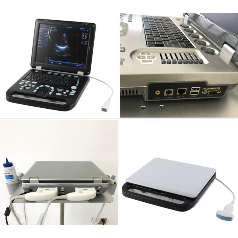 Medical equipments 192 elements good quality color doppler ultrasound