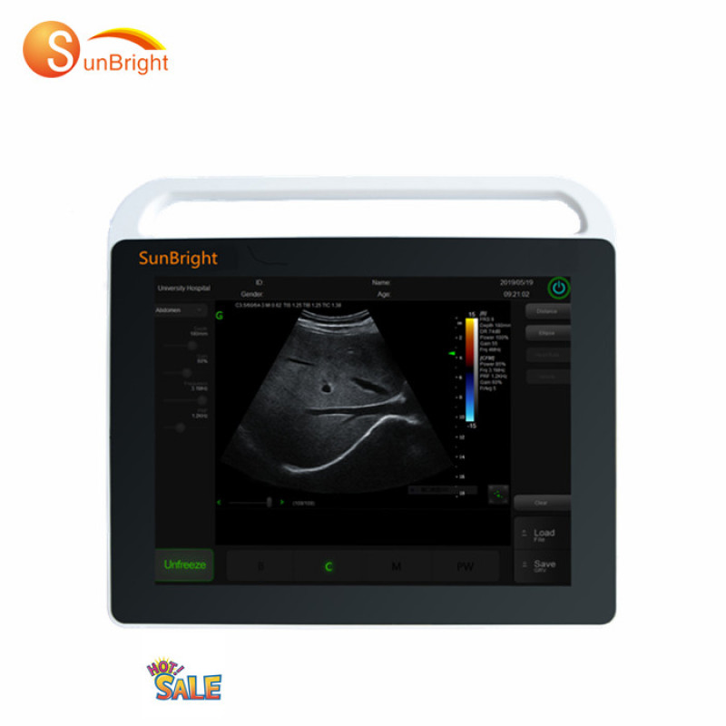 high resolution digital portable touch screen ultrasonic ecografo cheap portable ultrasound