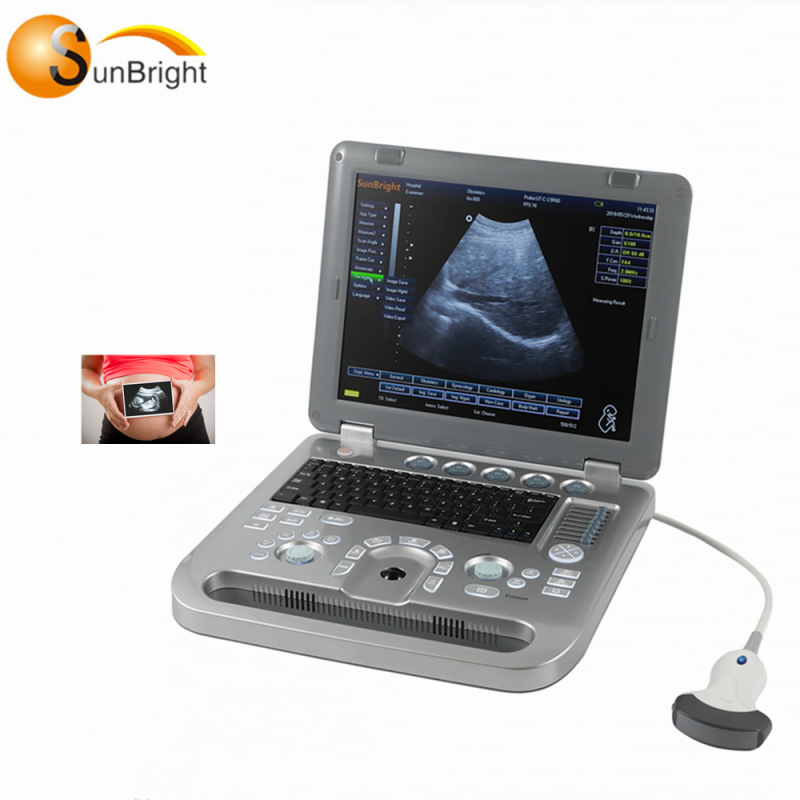 High performance 3D medical ultrasonic machines for sale echo