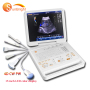 portable 3D/4D CW color doppler ultrasound scanner with probes