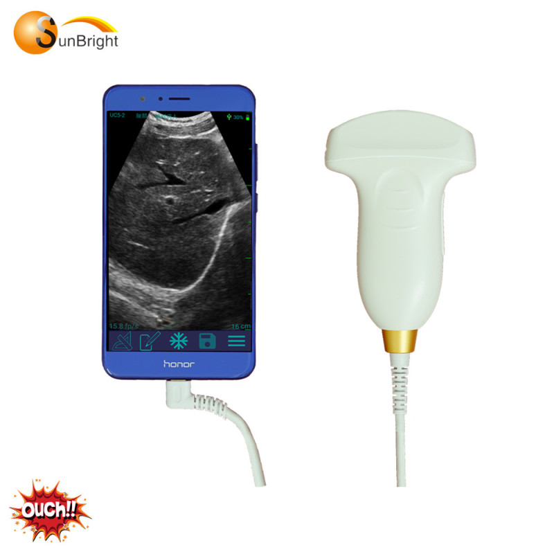 새로운 도착 볼록 USB 프로브 OB 진단 초음파 프로브 SUN-P1 의료 기계