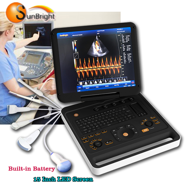 Portable personal 3D/4D CW color doppler ultrasound machine