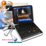 Portable personal 3D/4D CW color doppler ultrasound machine