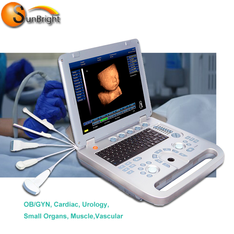 similar with chison eco3 ultrasound laptop 3D medical equipment