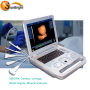 similar with chison eco3 ultrasound laptop 3D medical equipment