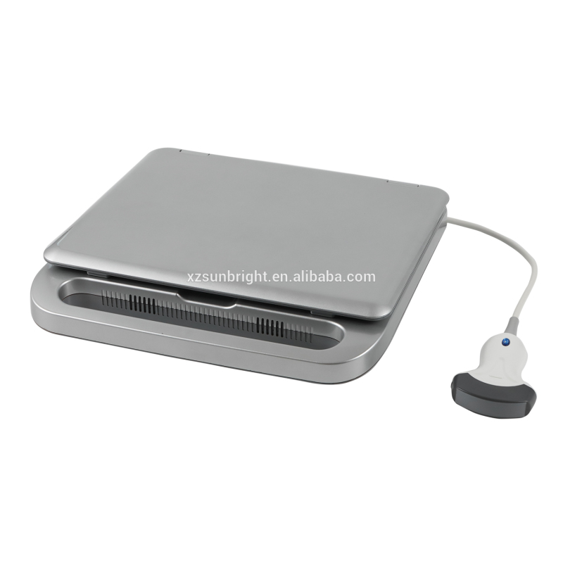 3D 노트북 초음파 스캐너 PC 기반 최고 인기기 SUN 800D