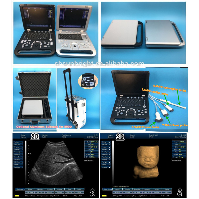 Portable 3d 4d veterinary ultrasound Equipment Machine for pig sheep cattle pregnancy test