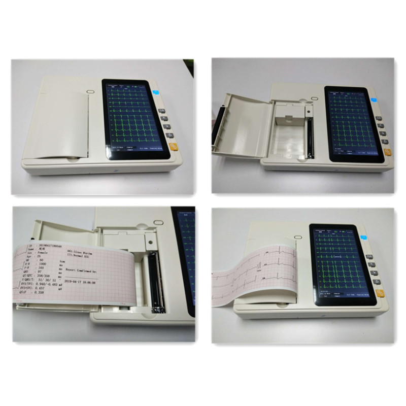 2021 أحدث مخطط كهربائي للقلب ECG ECG 12 يؤدي 3 قنوات ECG / EKG آلة