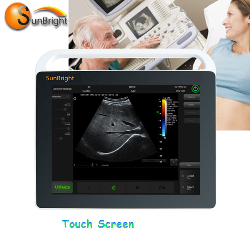 Medical equipment cheap price touch screen ultrasound imaging machine cost