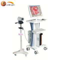 Portable gynaecology video colposcope price for vagina examination
