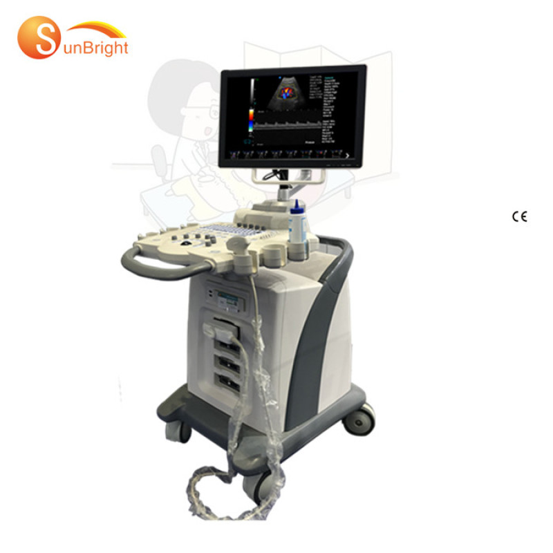 도플러 4d 트롤리 컬러 도플러 초음파 트롤리 카트 초음파 컬러 도플러 vscan 듀얼 스크린 기계