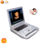 Hospital Cardiac Panoramic 3D 4D usg machine color doppler ultrasound machine price