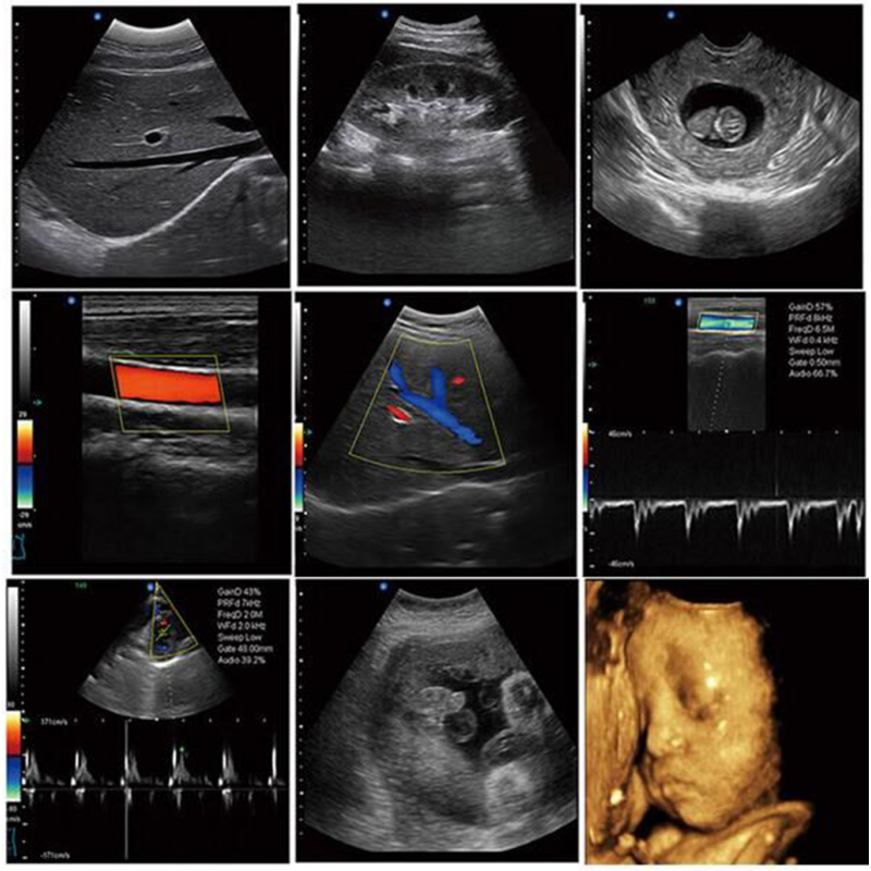 SUN-906A رخيصة كمبيوتر محمول محمول CW PW اللون الماسح الضوئي بالموجات فوق الصوتية دوبلر