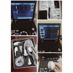 128 elements CE approved laptop portable 3D 4D ultrasound color doppler ultrasound price