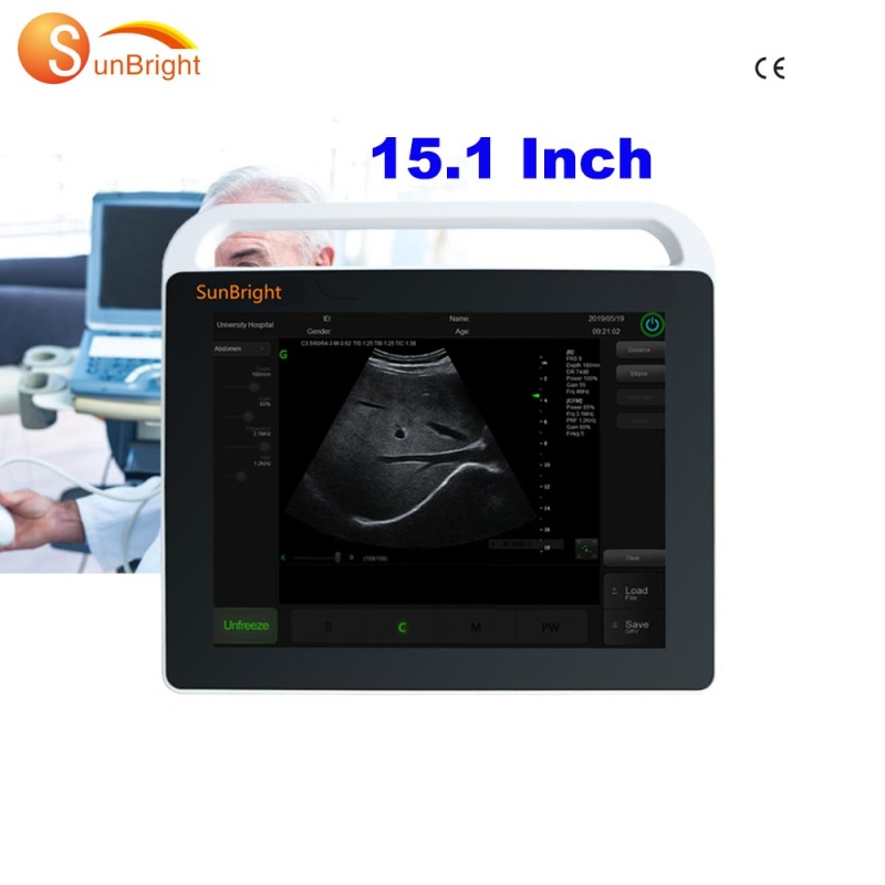 يحمل الطبيب وزنًا خفيفًا لاستخدام الموجات فوق الصوتية الطبية الشخصية للاستخدام في العيادة