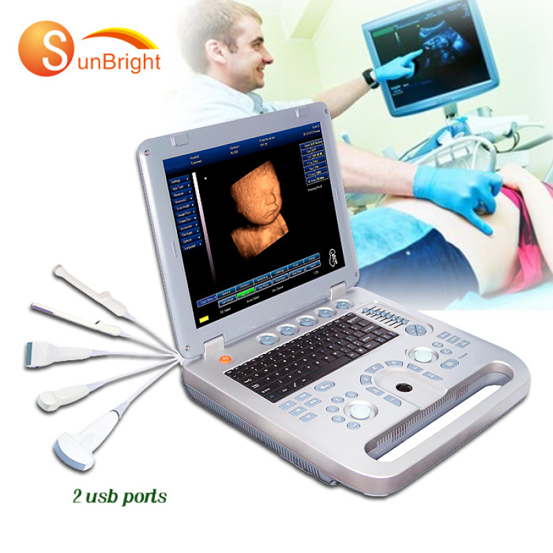 Sistema ecografico CE macchina ecografica portatile sonda lineare ecografica portatile veterinaria